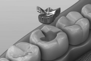 mercury-dental_20190918131321